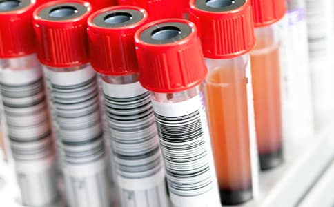 RFID高頻試劑稱重管理天線